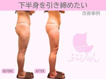 ぷるるんエステ/痩身/ダイエット/整体