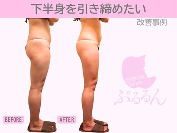 ぷるるんエステ/痩身/ダイエット/整体