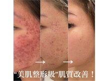 サロン エミリー(Salon Emily)の雰囲気（Salon de Emilyの本気！肌質改善はおまかせください。）