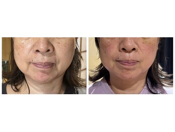 ねこのひげ/お顔の変化