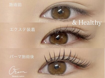 オルム(orem)の写真