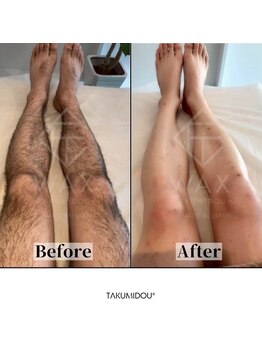 サロンエヌ 久留米店(Salon N)/