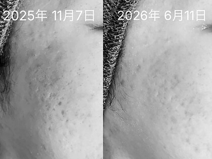 プレジール(plasir)の写真