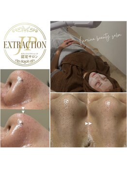 ルミナ(Lumina)の写真/ゴッソリ汚れが取れてツルツルに！他店とは一味違う【毛穴エクストラクション】