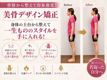 プレフェランス(Preference)