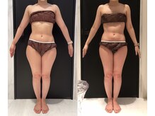 リボディ 表参道(An re Body)/before→after