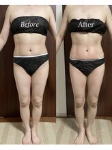 ヴィム(VIM)/ハイパーナイフビフォーアフター