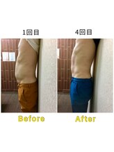 マリモ鍼灸接骨院/電磁パルス週1回　4回の結果