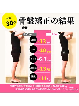 セレンディピティ 守山店(Serendipity)/30代 産後骨盤矯正、ダイエット