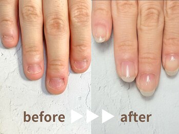 自爪育成で別人の手に♪右手