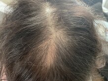 リノ(Lino)/ヘアーアディクト