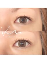 クレー(Klee)/ダブルフラット