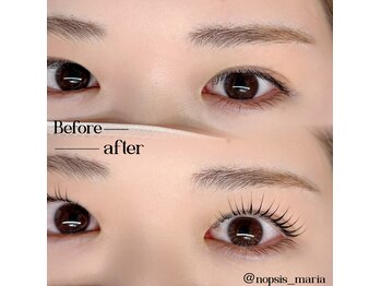 ノプシス(nopsis)