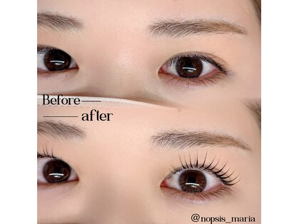 ノプシス(nopsis)の写真