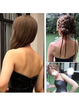 コーラル(Coral)/ブライダル痩身(施術結果)