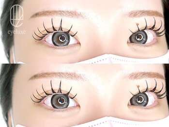 アイリュクス ブルーム(eyeluxe bloom)/アンドヘルシー