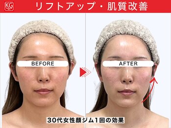 顔ジム 麻布店/顔ジム1回の効果