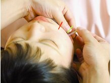 本厚木 リターナル(ReTurnal)の雰囲気（大人気鍼灸でお身体のお悩みを解決♪美容鍼で小顔、リフトアップ）