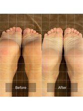 リハリ 本町院(///Rehari)/骨盤矯正