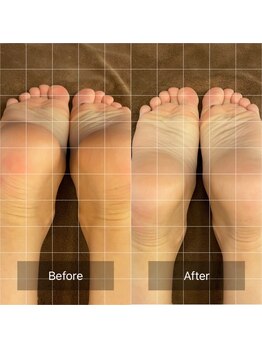 リハリ 本町院(///Rehari)/骨盤矯正