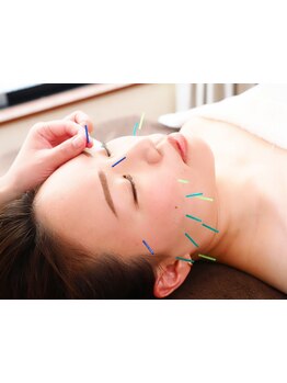 鍼灸施術を受けたい