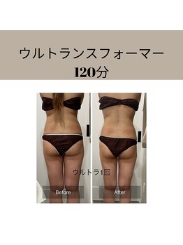 トータルビューティ リライフ(Total beauty Relife)/美脚になりたいな～が叶う