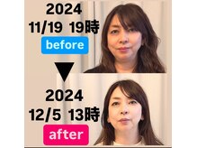 メゾン ド クロエ(Maison de Chloe)の雰囲気（【たるみ改善復元ダイエット】１回目からマイナス5キロ見え）