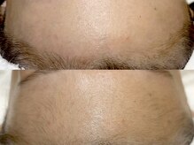 ラニブロウ(Lani brow)/アンプルフェイシャルワックス＊