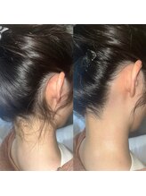 ナビレラ 自由が丘(Navillera)/うなじワックス