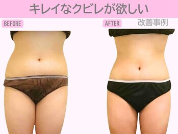 ぷるるんエステ/痩身/ダイエット/整体