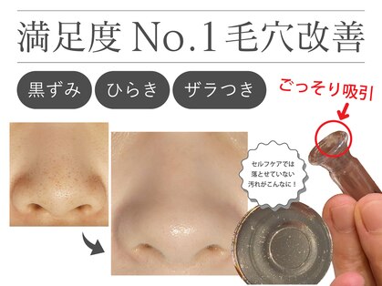 オーシャンブルー 福岡店(OCEAN BLUE フェイシャル&ボディ)の写真