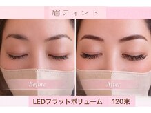 チック(chick)/LEDフラットボリューム120束