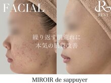 ミロワール ドゥ サピュイェ(MIROIR de Sappuyer)