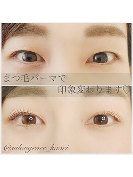 グレイス(grace)/