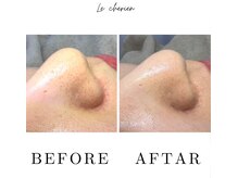 ルシェリア(Le cherien)/ハイドラフェイシャル