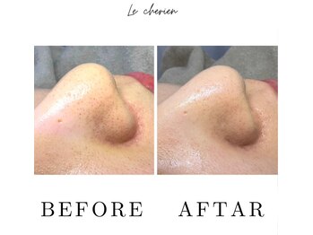 ルシェリア(Le cherien)/ハイドラフェイシャル