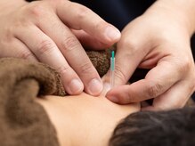 ひなた堂鍼灸整骨院