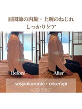 ロータス(LOTUS)/巻き肩改善！頭蓋×猫背矯正
