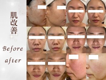 リボーン(Reborn)