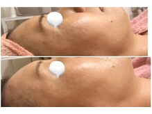 ロゼブランシュ(Rose Blanche)/