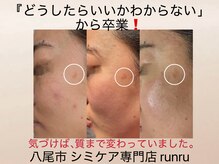 ルンルン(run run)/