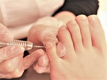 サロン ド ピュアボディ(salon de PureBody)/施術～爪周りの角質ケア