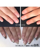 リノール(Linol)/