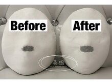 美極 トータルビューティー(美極 TOTAL BEAUTY)/恵比寿/小顔コルギ/エステ/