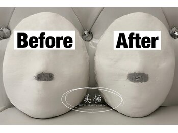 美極 トータルビューティー(美極 TOTAL BEAUTY)/恵比寿/小顔コルギ/エステ/