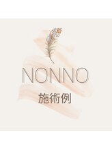 ノンノ 板橋(NONNO)/【施術デザイン例】