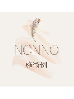 ノンノ 板橋(NONNO)/【施術デザイン例】