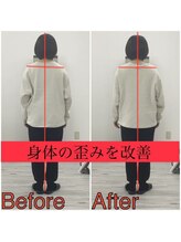 かたぎ整体組 徳島店/施術前／施術後