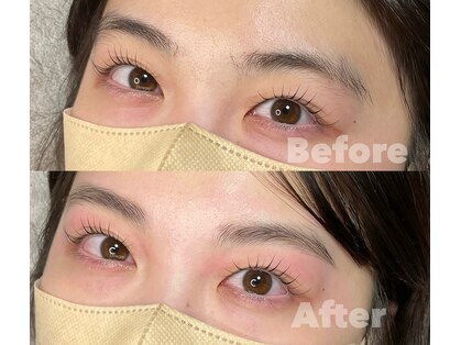 ダウニー(Downy)の写真