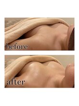 アンドボディ 横浜元町(&Body)/バストアップ/横浜元町